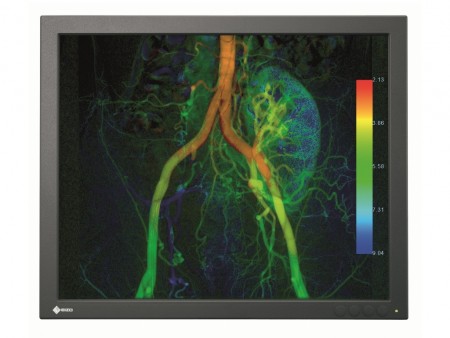 輝度700cd/㎡、X線透視画像向け19インチカラー液晶、EIZO「CuratOR EX190」